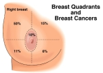 Breast quadrants and cancer incidence